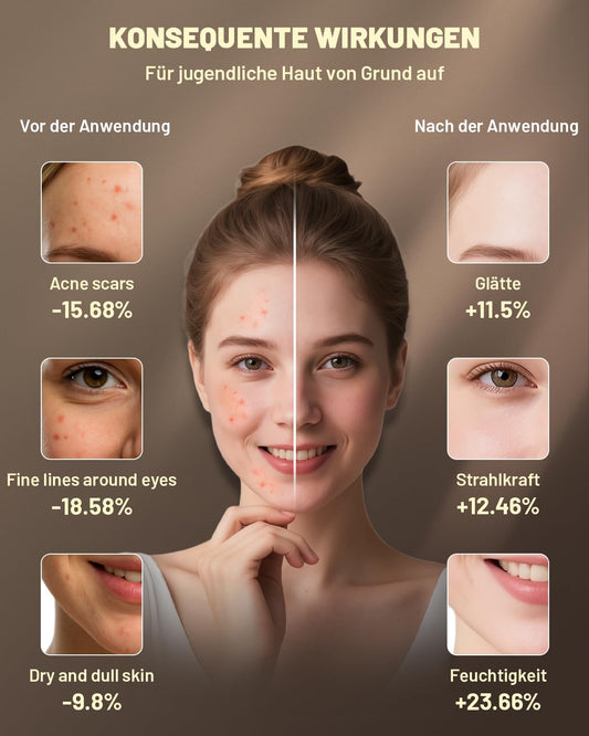 Led Maske Gesicht mit 3 Modi, Aufladbar Fernbedienung, Led Gesichtsmaske mit Nahinfrarot Mit Reisetasche für Zuhause & Reisen, 400 LEDs